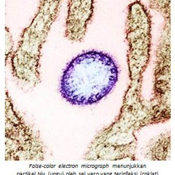 VIRUS NIPAH (Niv)